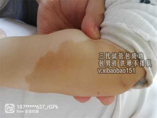 广州60万包生男孩_子宫腺肌做试管婴儿需要注意什么事情